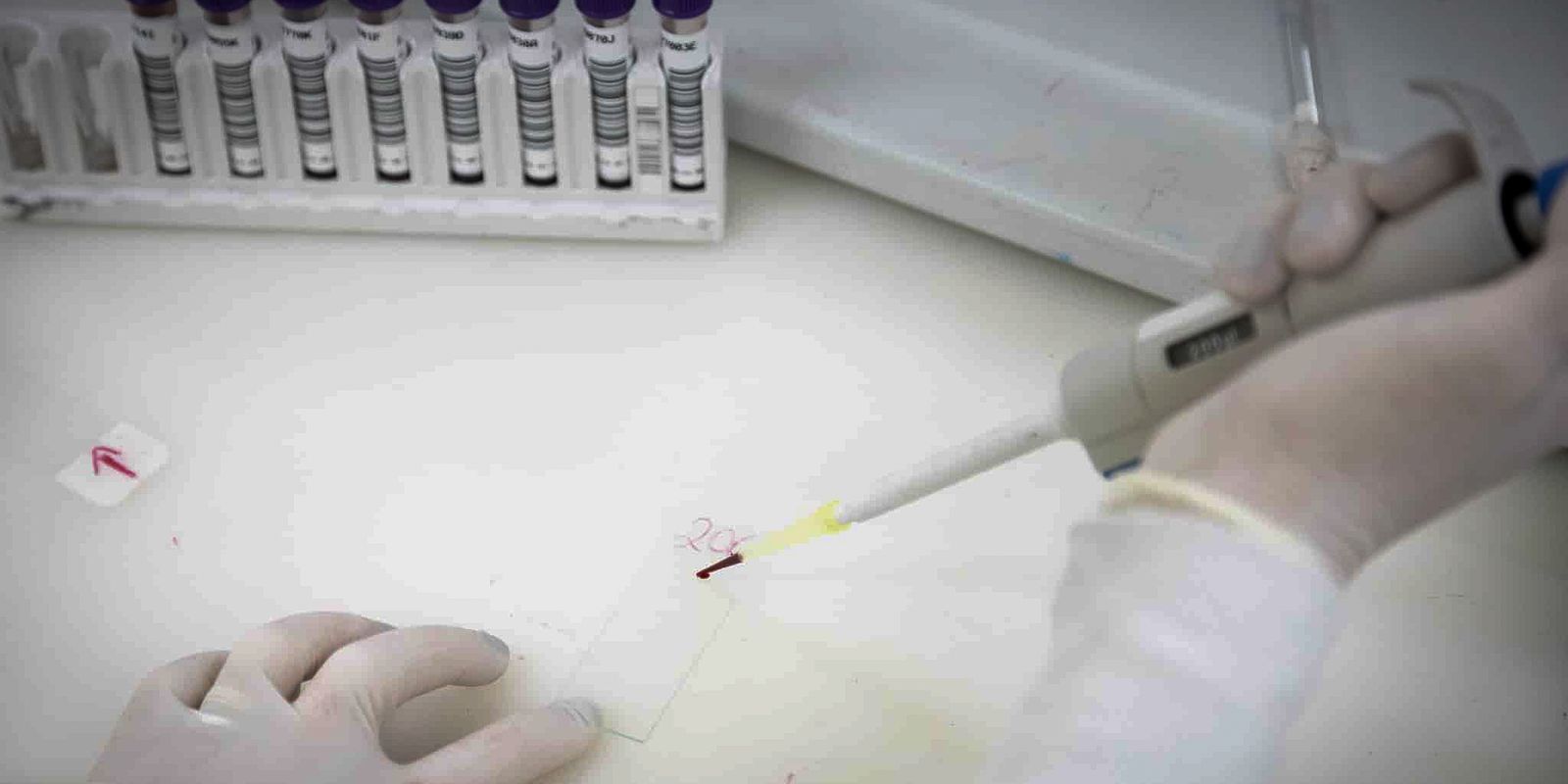 Exames Descartam Ebola em Imigrante da República Democrática do Congo